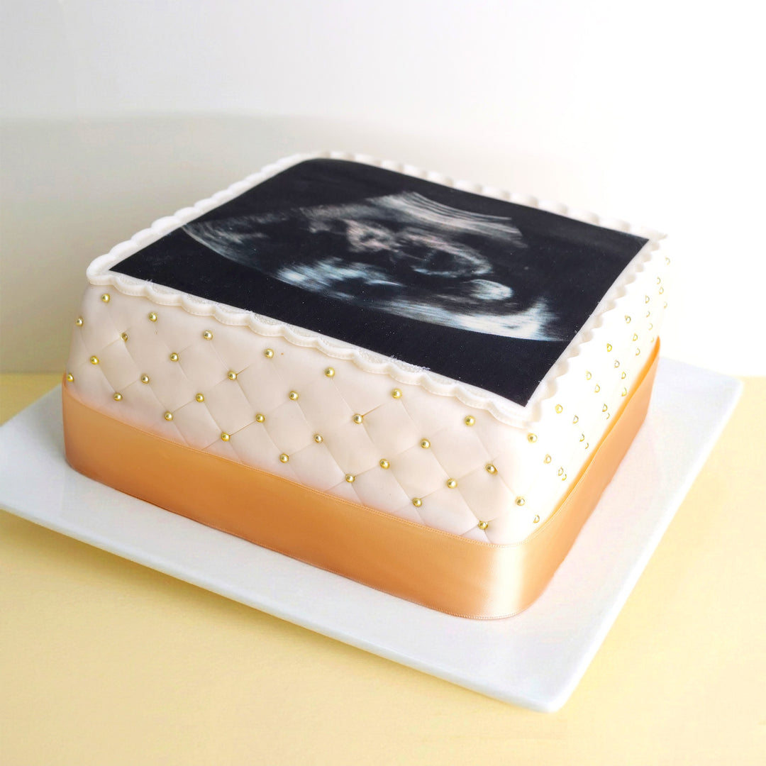 Quadratische Ultraschall-Torte Deluxe mit eigenem Foto – doppelte Höhe